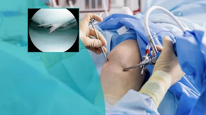 12-Arthroscopy