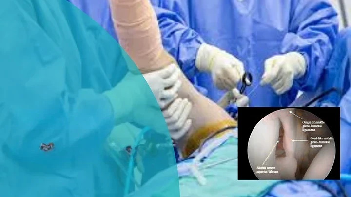 13-Arthroscopy
