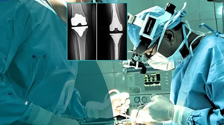 7-Joint-Replacement-Surgery